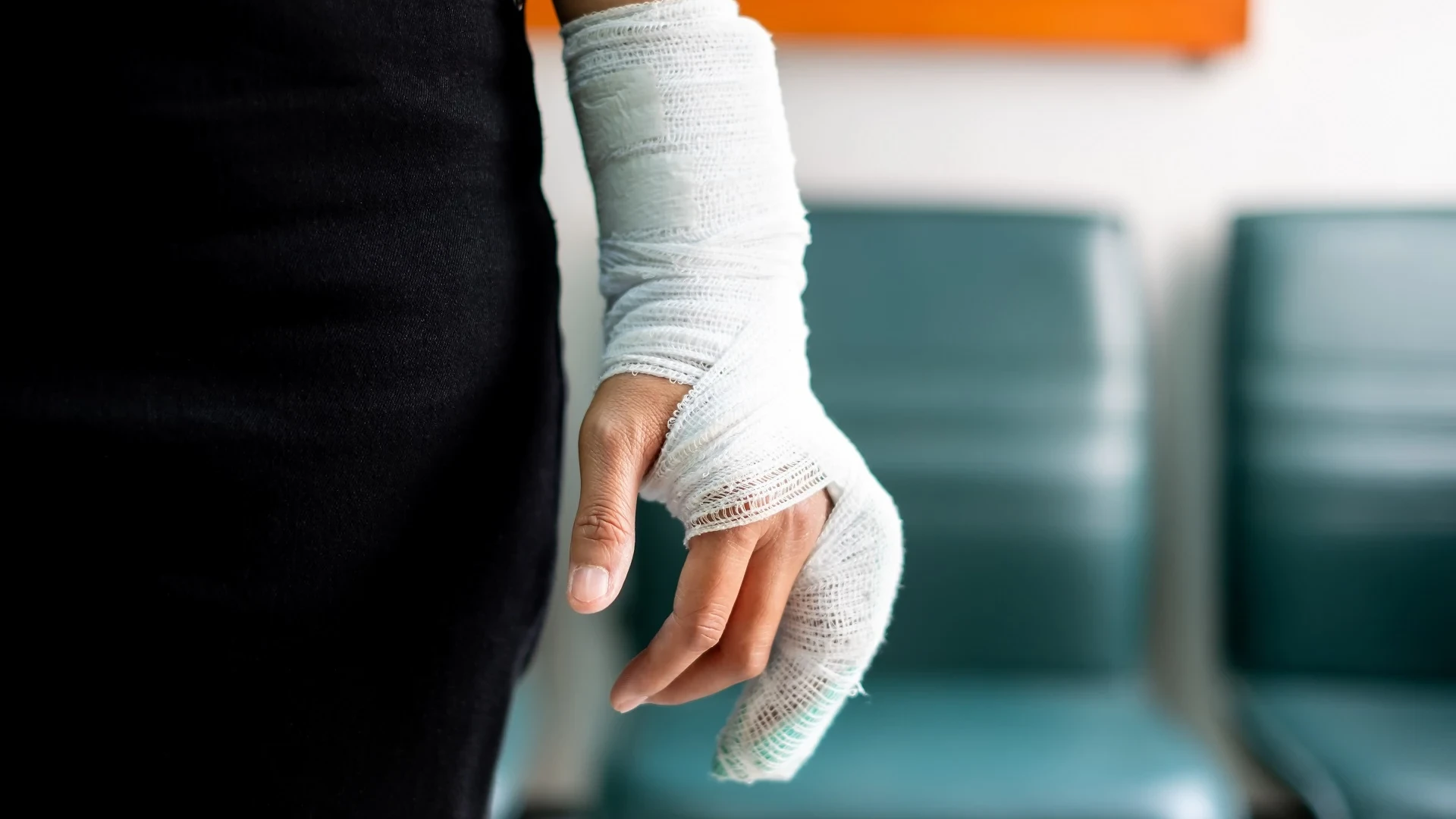 Woman with an arm cast on.